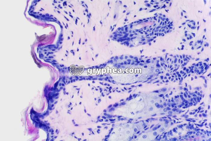 Peau avec glandes sébacées x100 - gryphea.org